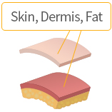 Separated into skin, dermis and fat layers