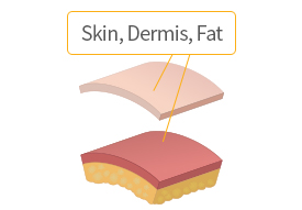 Separated into skin, dermis and fat layers