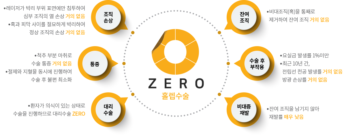 ZERO 홀렙수술 6가지 특징