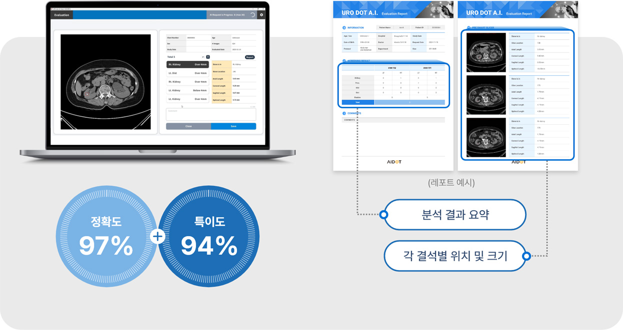 정확도 97% + 특이도 94%