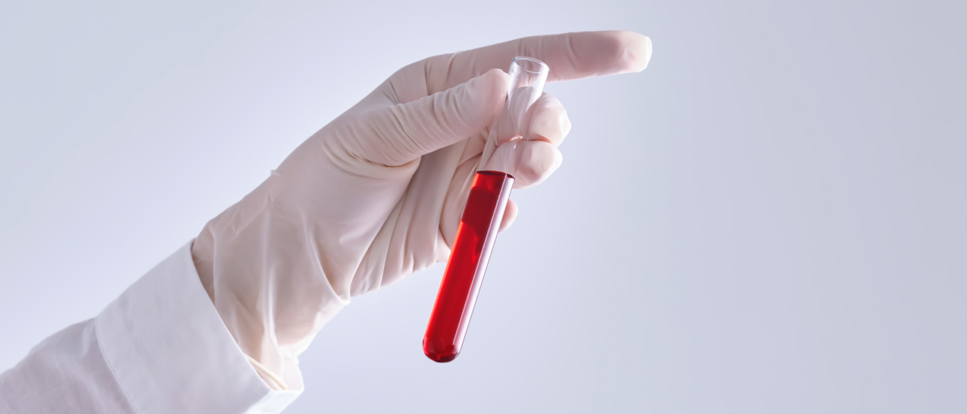 Multi-PCR 검사 상징 이미지
