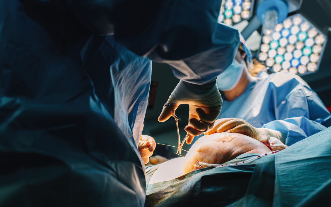 수술 중인 의료진