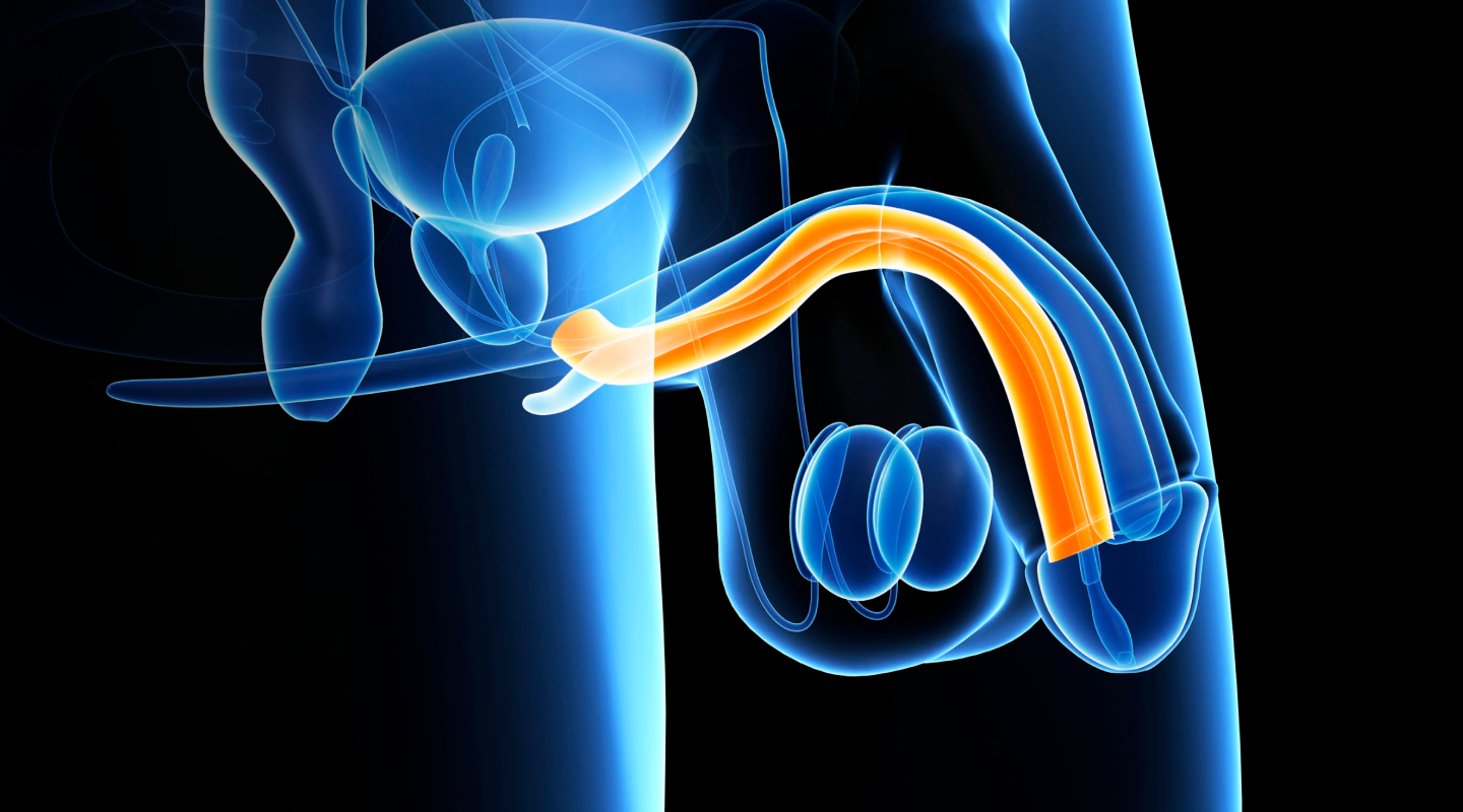 음경보형물 3D 일러스트