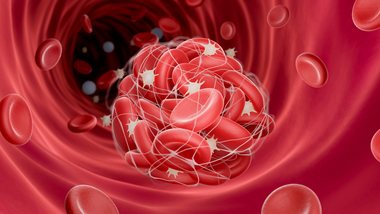 치료 전 적혈구 일러스트