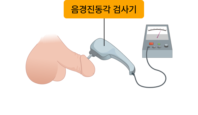 음경진동각 검사기