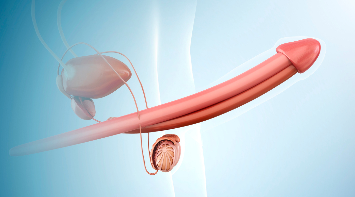 최소절개 음경확대술 일러스트