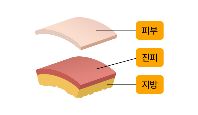 피부/진피/지방 일러스트