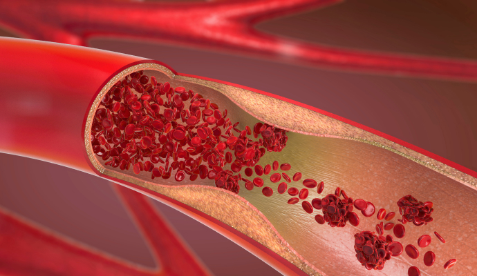 림프절 일러스트