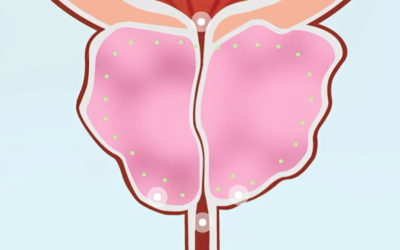 초음파 일러스트