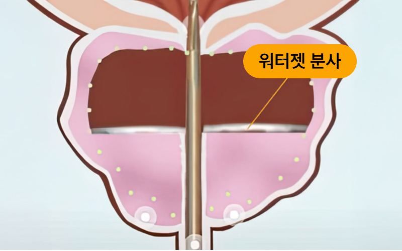 워터젯 분사 일러스트