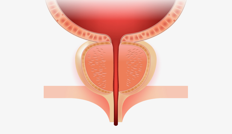 정상 전립선 일러스트