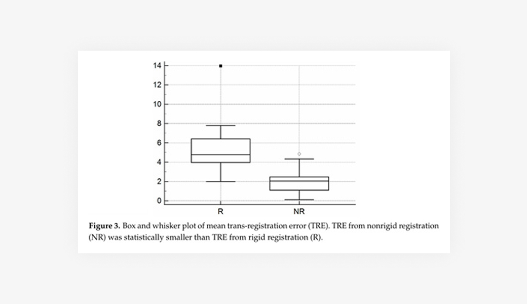 MR 퓨전 조직검사 진단 화면