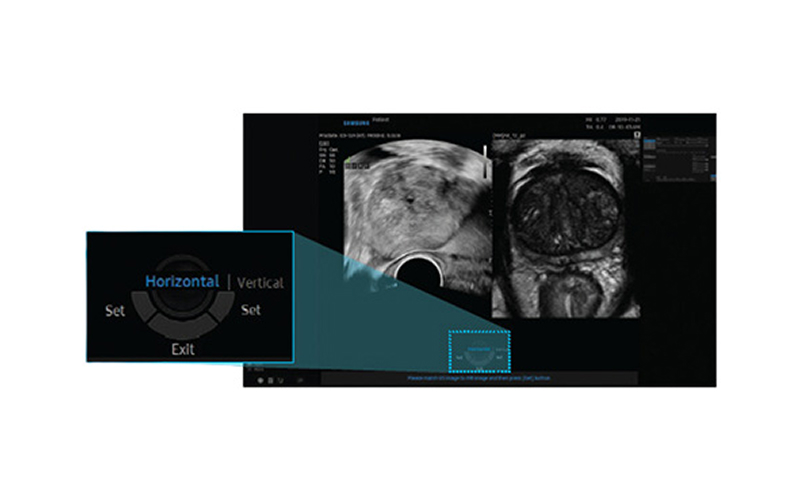 초기 등록 화면