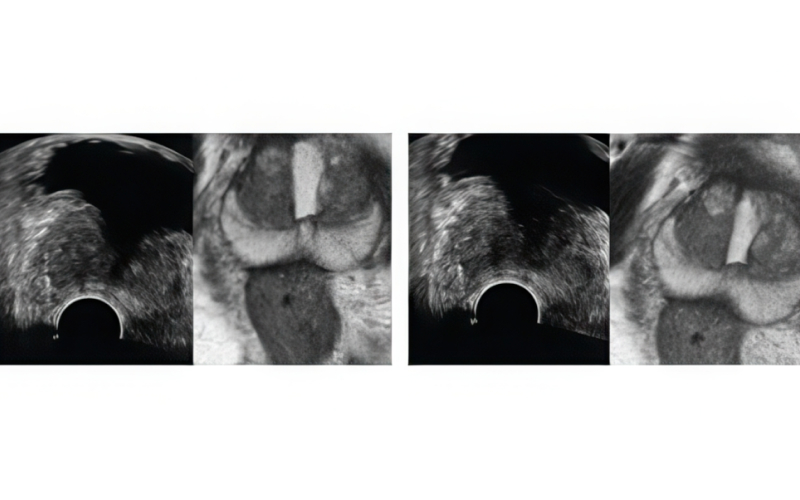 AI 실시간 자동 보정 화면