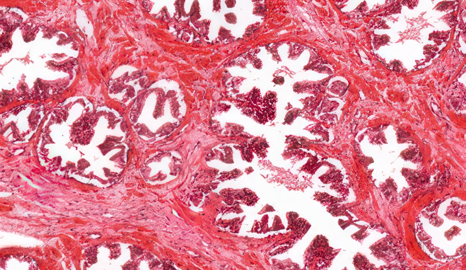 전립선 정상 조직