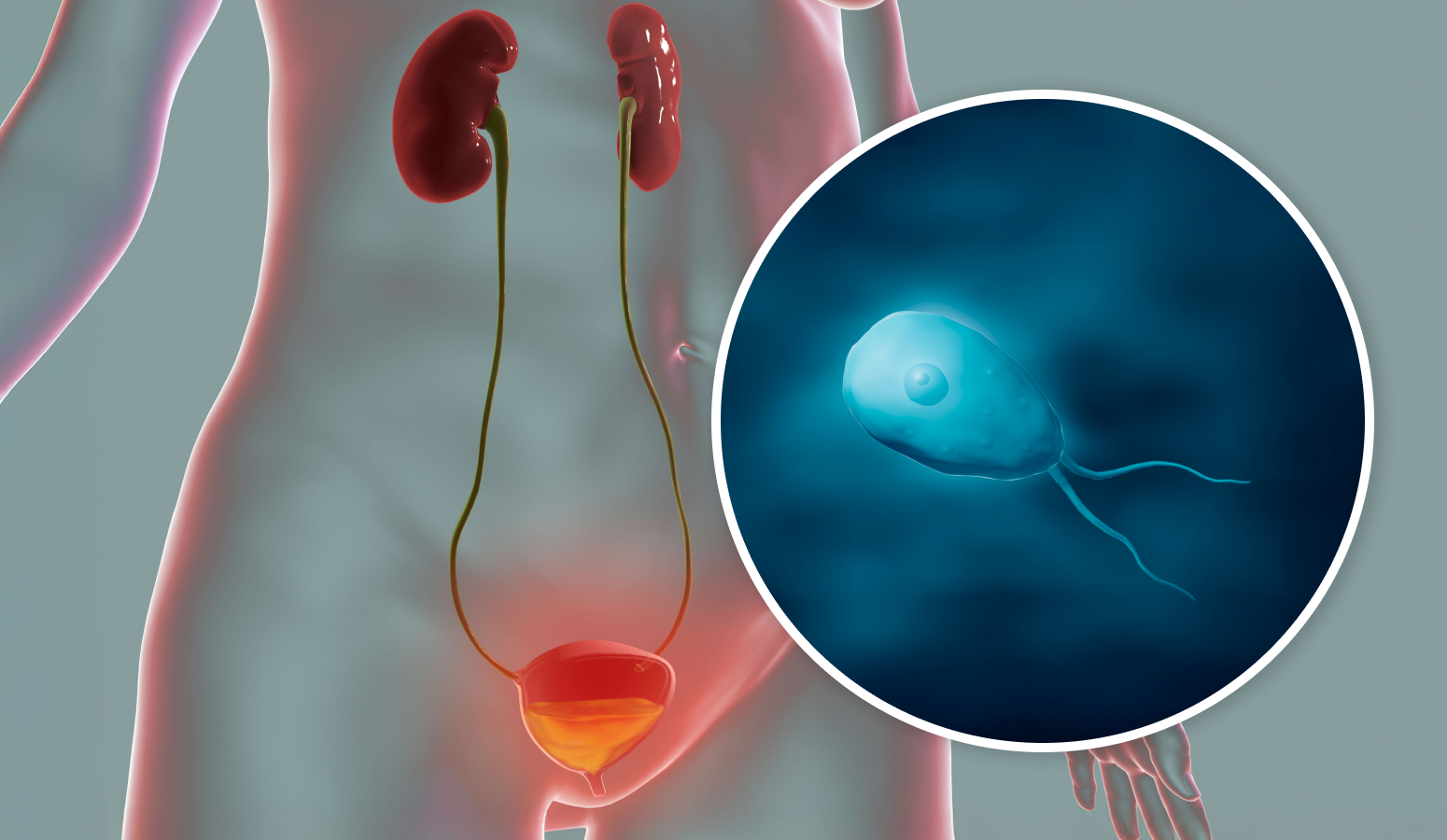 질과 원충 일러스트