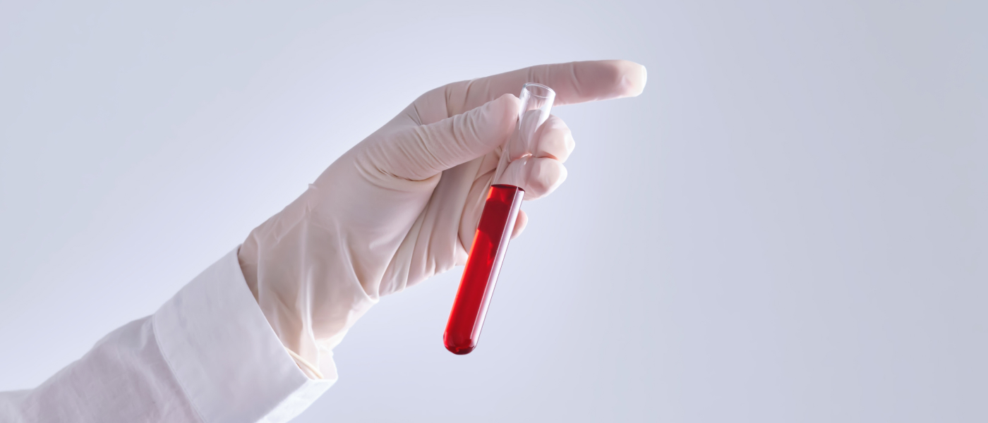 유전자 증폭 검사