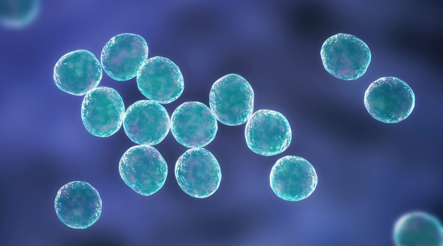 유레아플라즈마