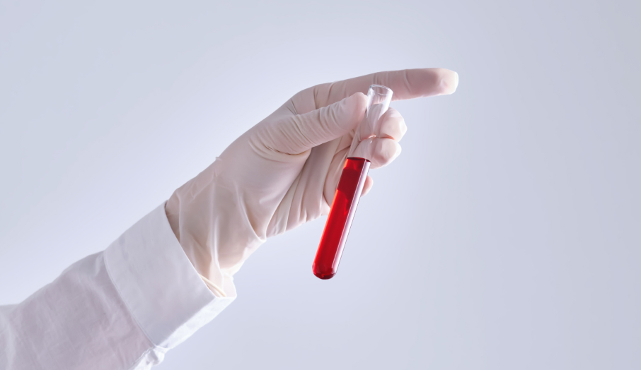 유전자 증폭 검사