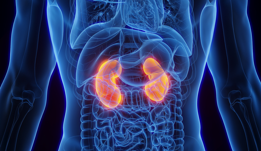 요관경 접근이 어려운 신장 구조