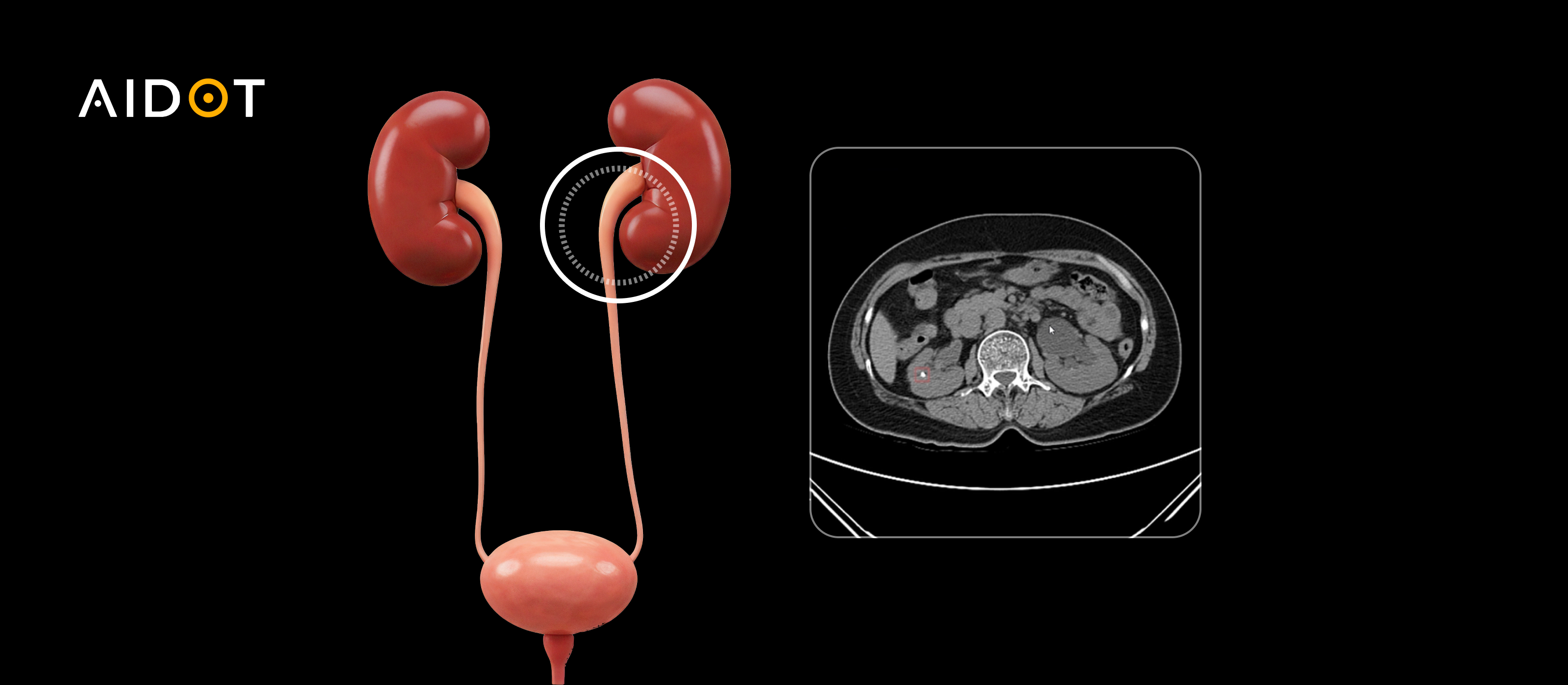 유로닷 CT 스캔 이미지