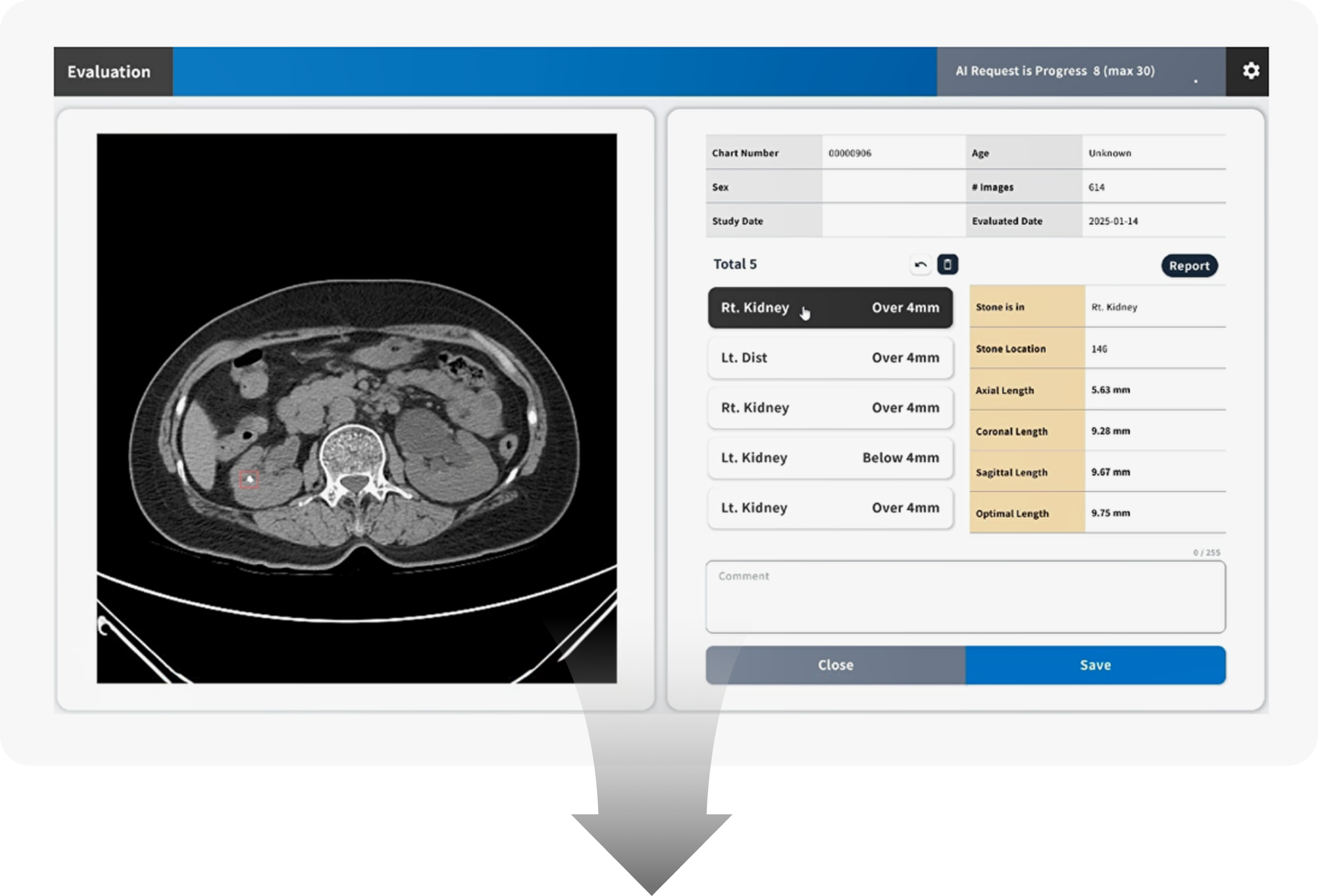 유로닷 AI 결과 화면