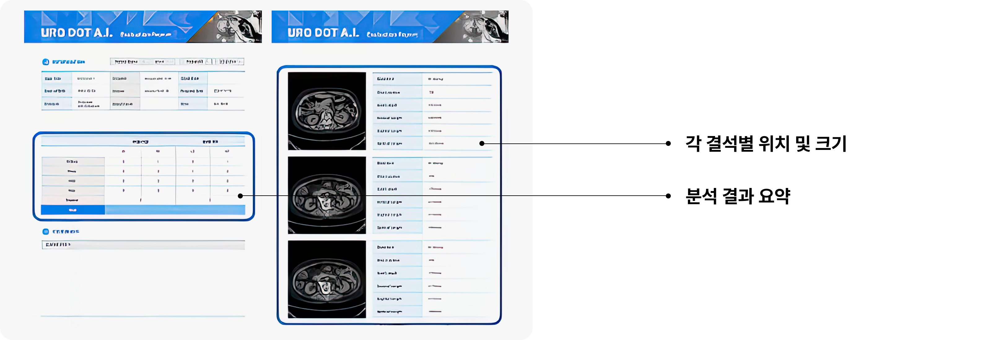 각 결석별 위치 및 크기/분석 결과 요약 화면