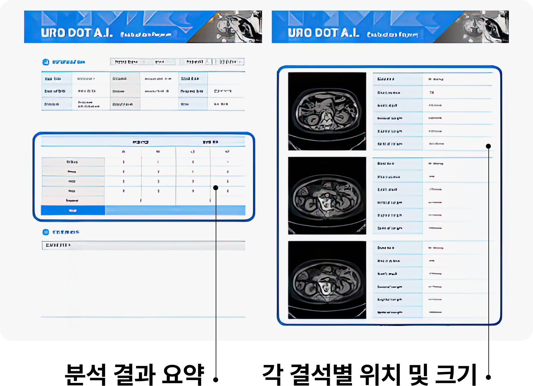 각 결석별 위치 및 크기/분석 결과 요약 화면