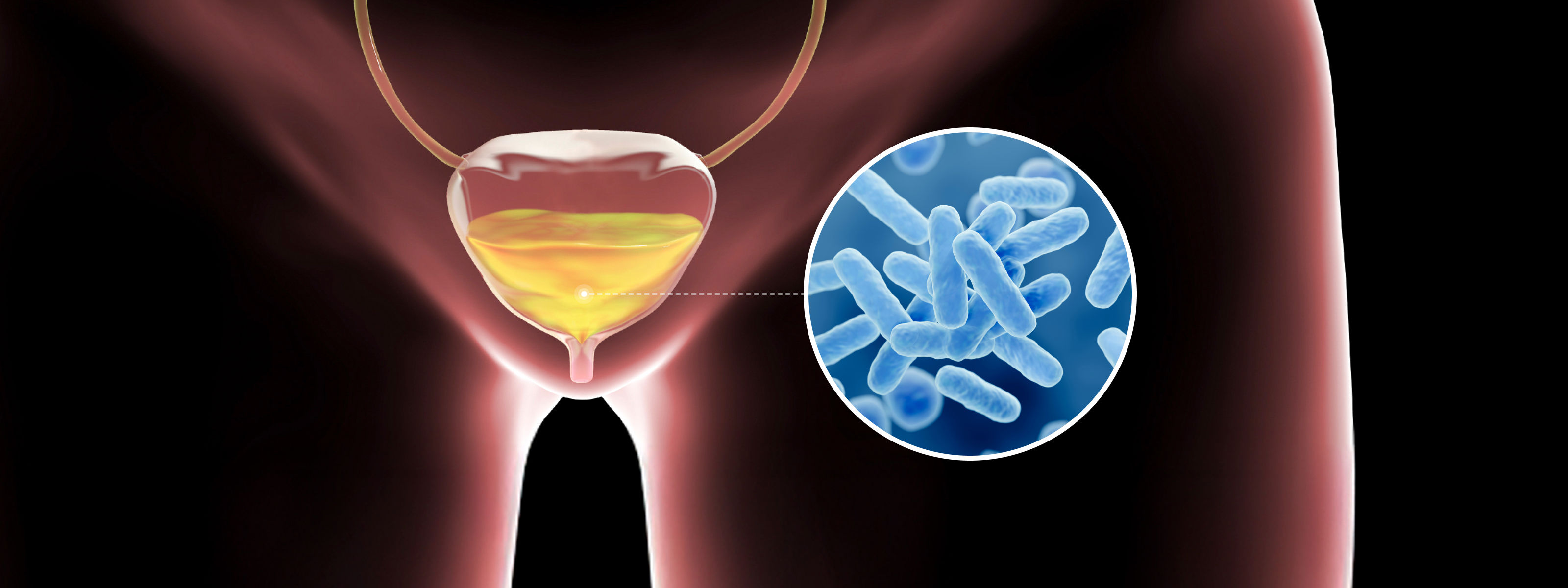 방광과 균 일러스트