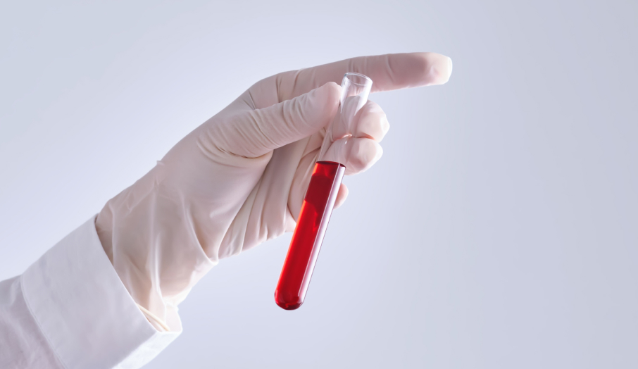 혈액검사