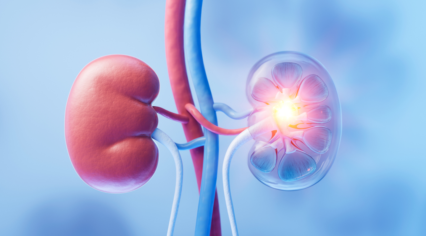 신우신염 일러스트