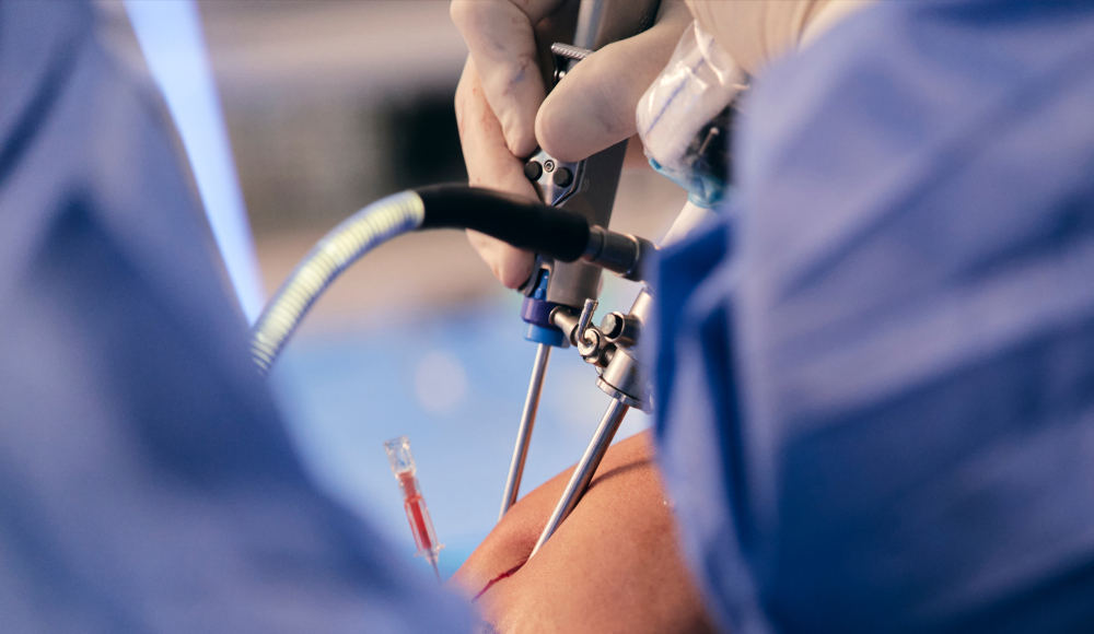 특수 미세 내시경 시술 장면